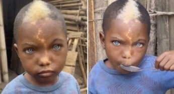 A viral sensation: Young boy with blue eyes, white hair, and lightning bolt mark on his face.